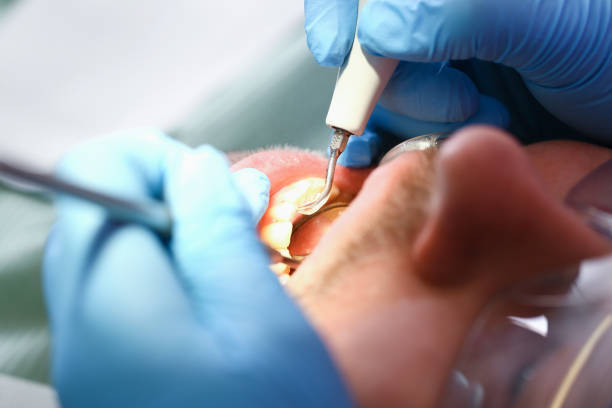 Best Urgent Dental Care for Toothache in Berne, IN